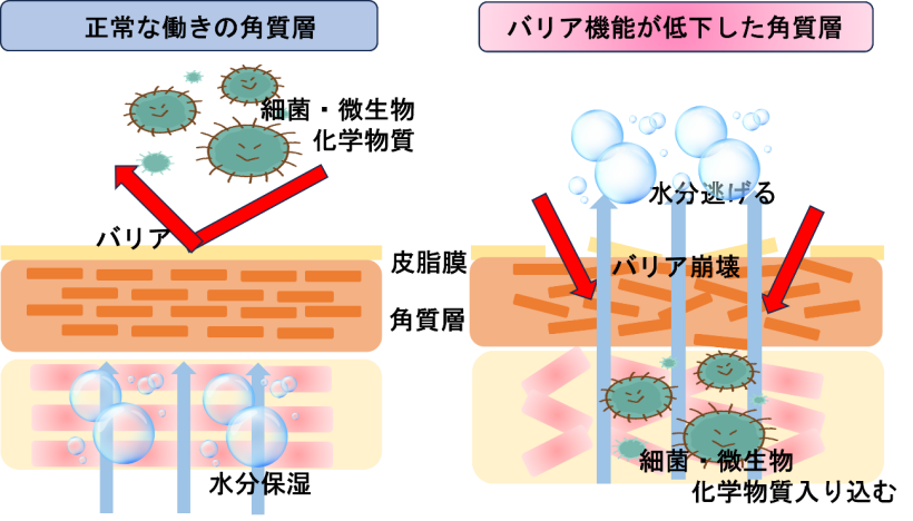 肛門掻痒（そうよう）症