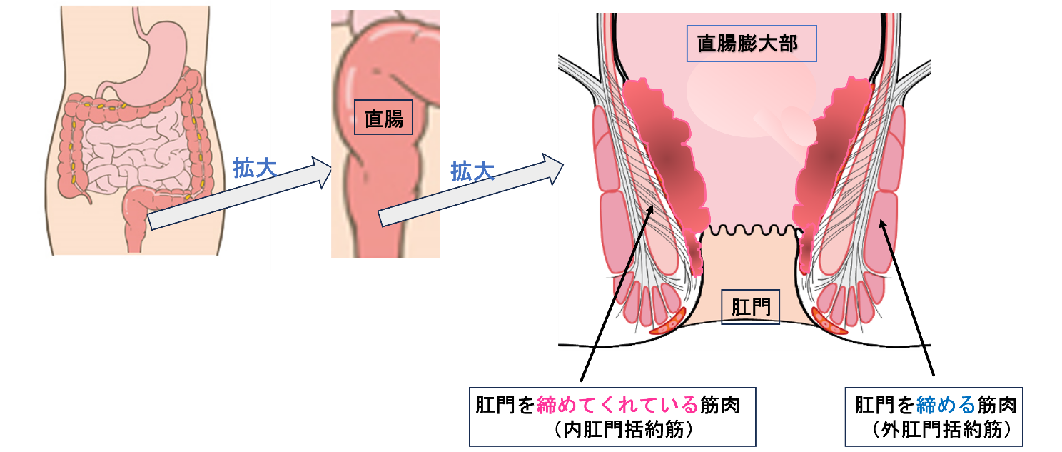 『直腸膨大部』