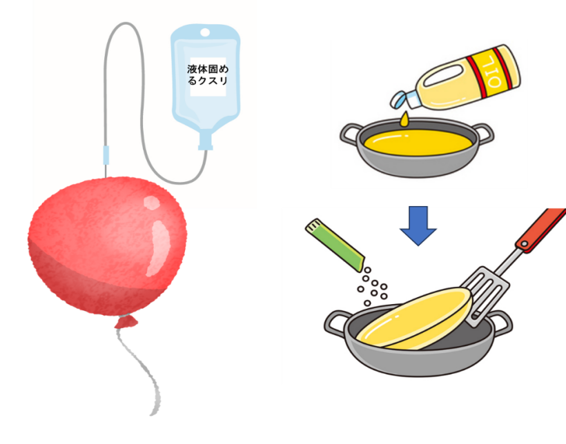 『痔核の硬化療法』＝『風船の中の液体を固めるクスリ注入』≒『油を固める粉』