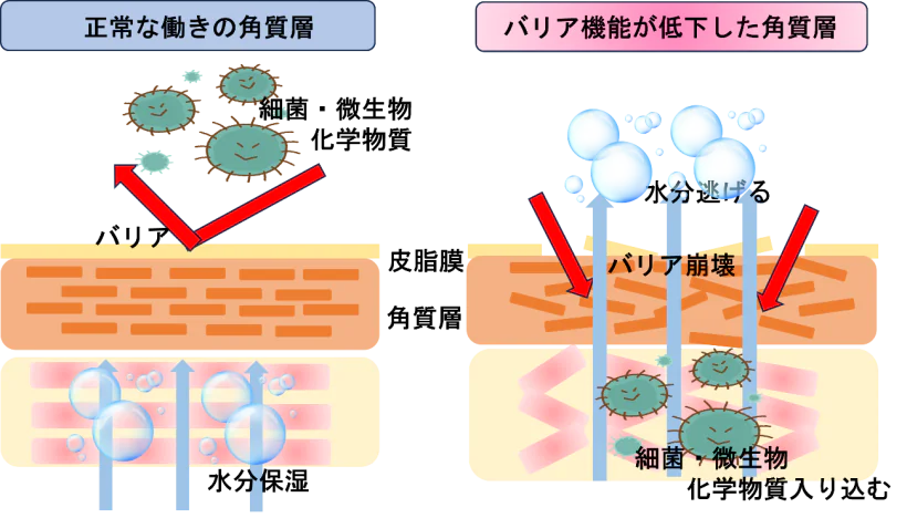 肛門のかゆみについて