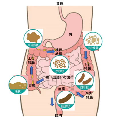 『痔』と『大腸がん』との関連について