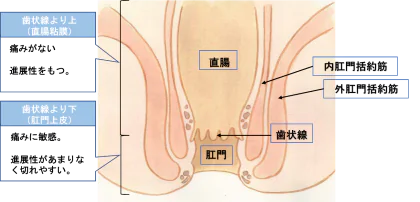 『いぼ痔（痔核）』とは？